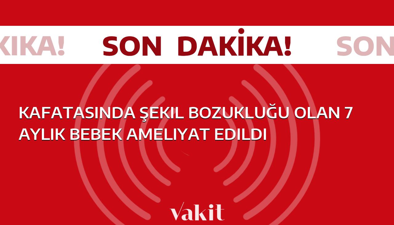 7 aylık bebek ameliyat edilerek kafatasındaki şekil bozukluğu düzeltildi